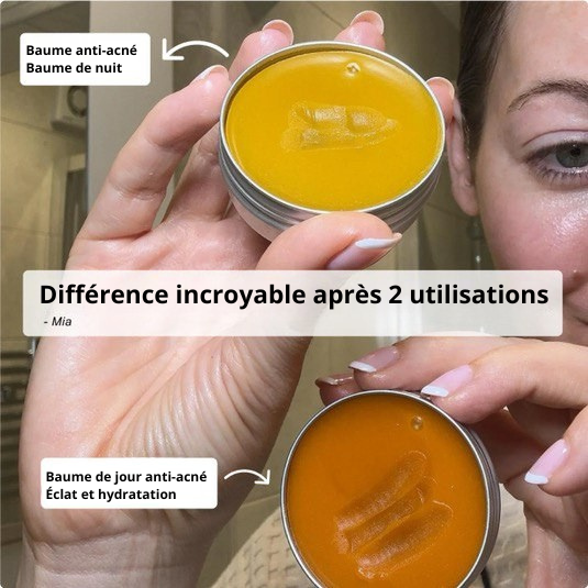 baume elimine acné et rougeur visage,
